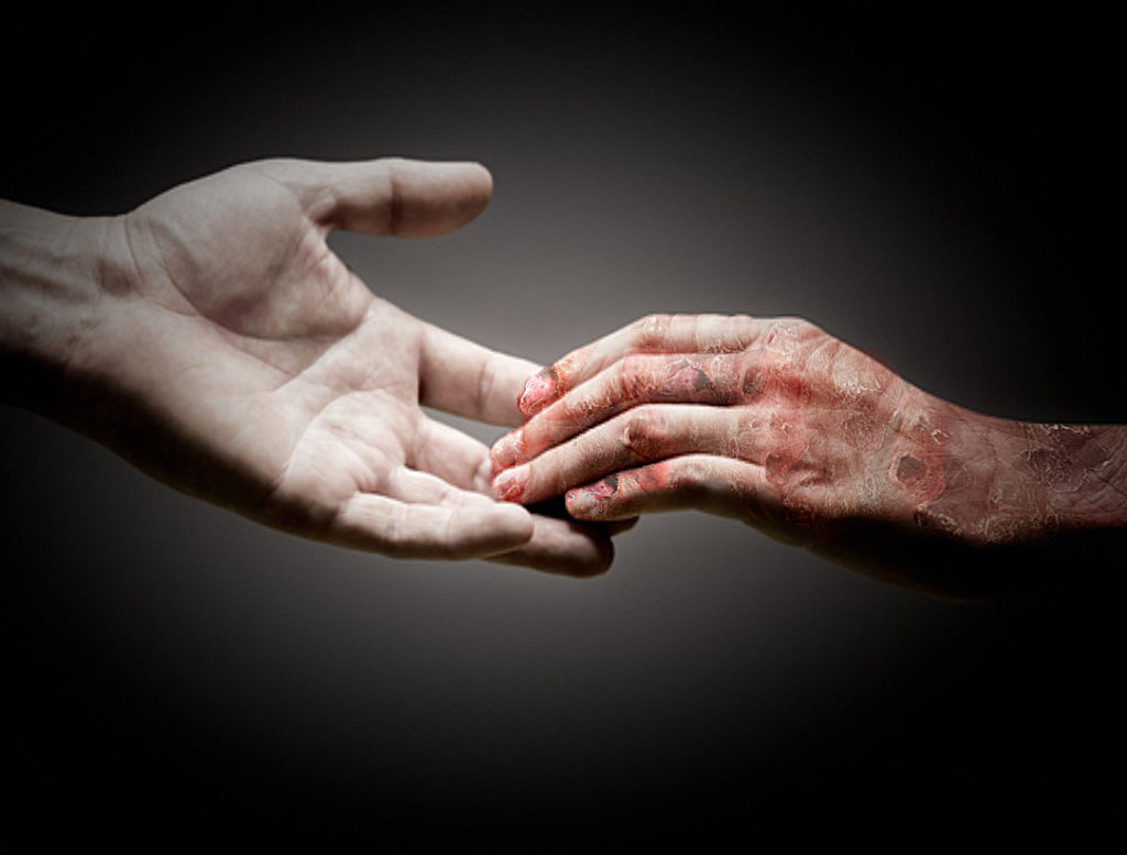 Battista Borsato “Gesù guarisce!” – #InCammino, image size:1024x777